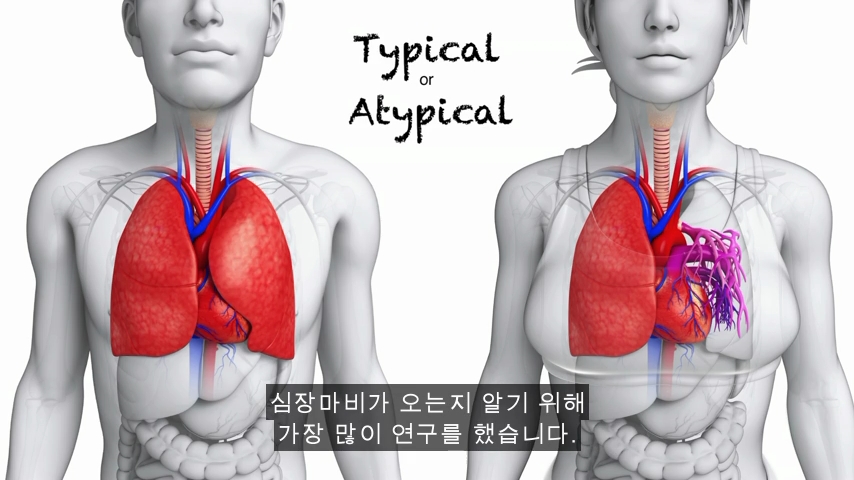 [TED] 왜 약은 종종 여성에게 위험한 부작용이 있는가 | 인스티즈