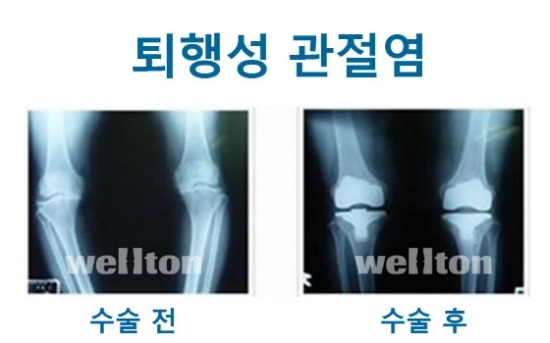 곧은 이미지