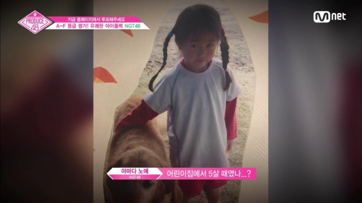 프듀48 아마다 노에 목소리 허스키하게 된 이유.jpg | 인스티즈