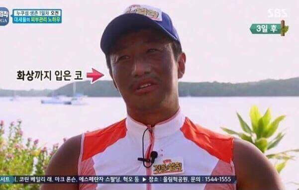 선크림 허세의 최후 | 인스티즈